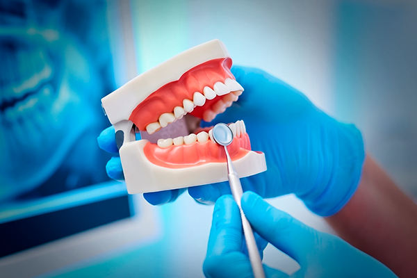 img-capa-card-curso-protese-dentaria