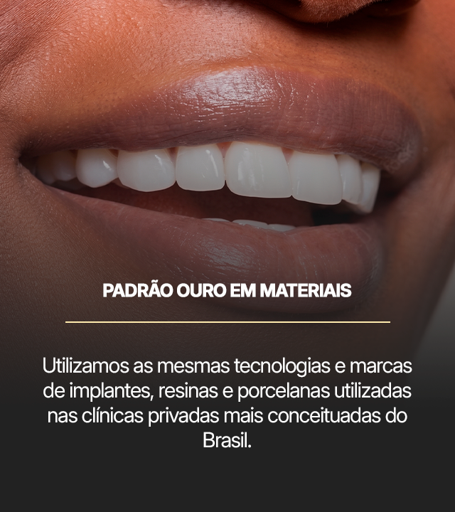 img-padrao-ouro-em-materiais